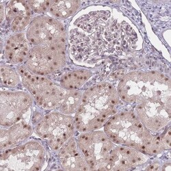 ZC3H14 Antibody, Novus Biologicals 0.1mL; Unlabeled:Antibodies, Polyclonal